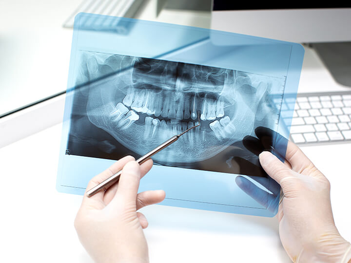 Radiologia e Ortopantomografia Dentária